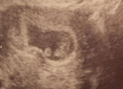 8wks.webp