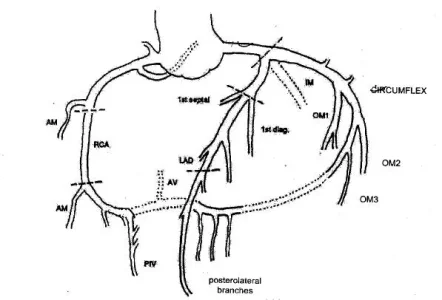 coronary.angiogram.webp