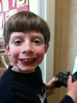 alexs-tooth-broke-4.webp