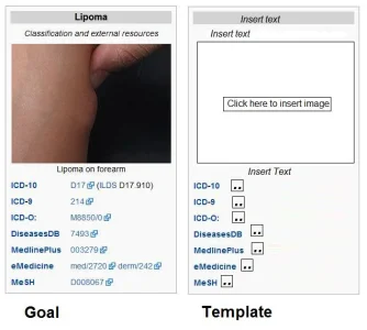 wikipedia.lipoma.ICD10.structured.data.blank.webp